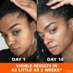 Palmer's Skin Success Anti-Dark Spot Fade Cream with Vitamin E and Niacinamide, for All Skin Types 2.7 Ounce - Image 7