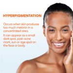 Palmer's Skin Success Anti-Dark Spot Fade Cream with Vitamin E and Niacinamide, for All Skin Types 2.7 Ounce - Image 8