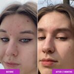 Good Molecules Niacinamide Serum - 10% Niacinamide to Target Acne, Nourishment, and Skin Tone - Ultra Hydrating Serum and Brightening Skin Care for Face - Image 5