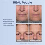 Plexaderm Rapid Reduction Eye Serum - Visibly Reduces Under-Eye Bags, Wrinkles, Dark Circles, Fine Lines & Crow's Feet Instantly, Anti Aging Wrinkle Remover for Face, Full Size Tube - Image 5