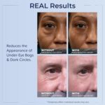 Plexaderm Rapid Reduction Eye Serum - Visibly Reduces Under-Eye Bags, Wrinkles, Dark Circles, Fine Lines & Crow's Feet Instantly, Anti Aging Wrinkle Remover for Face, Full Size Tube - Image 7