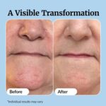 Vibriance Super C Serum for Mature Skin - All-in-One Vitamin Formula Hydrates, Firms, Lifts, Smooths, Targets Age Spots, Wrinkles, 1 fl oz - Image 6