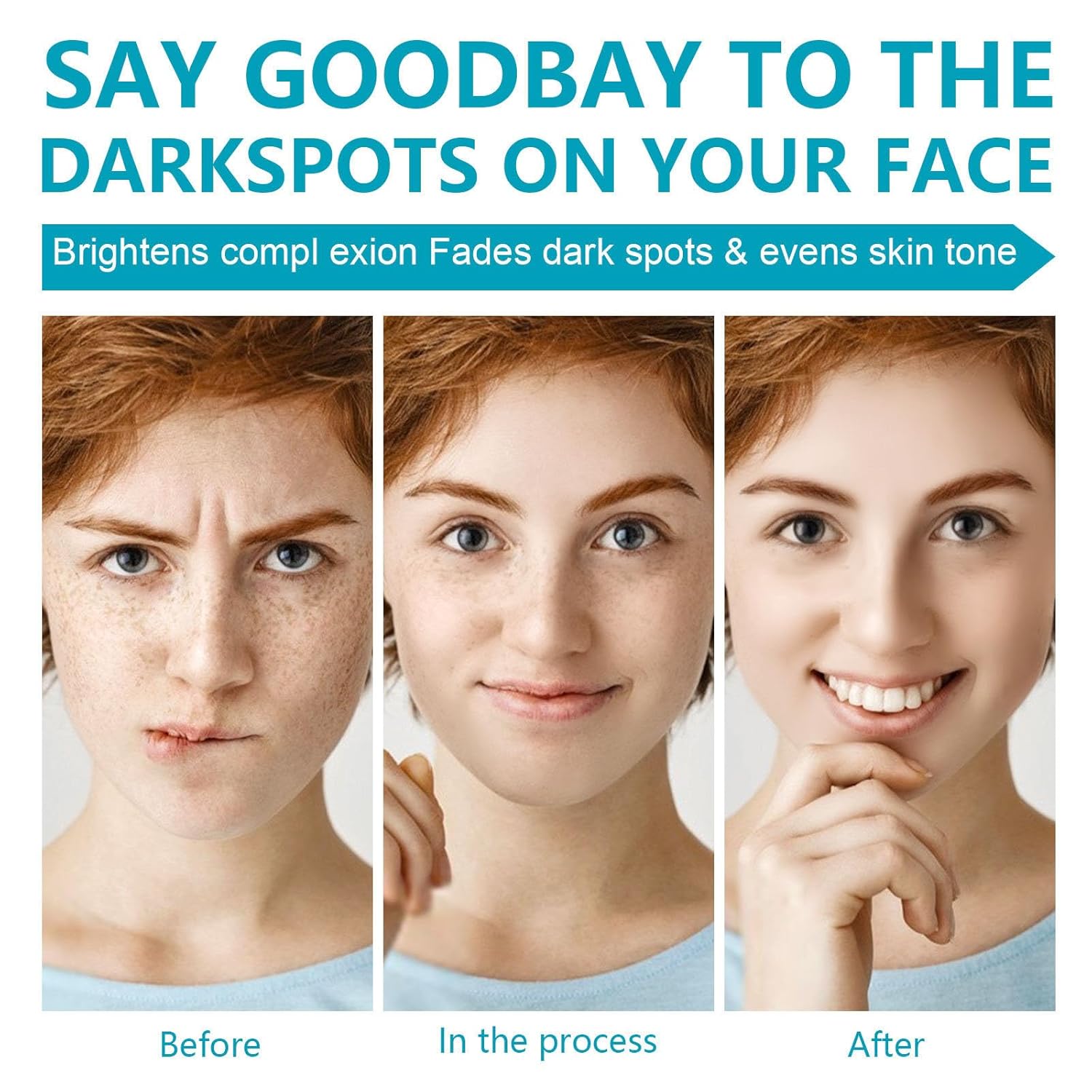 Dark Spot Remover for Face and Body, Dark Spot Corrector Cream, Dark Spot Corrector Cream for Age Spot, Blemish Spot, Melasma, Freckle, Sun Spots Remover & Blemish Reducer for Women Men - Image 5