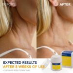 Korean Neck Cream for Firming & Tightening: Neck & Chest Anti-Aging Treatment for Crepey Sagging Skin & Wrinkles - Image 9