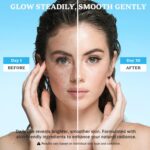 Dark Spot Remover for Face and Body: Dark Spot Corrector Cream, Melasma, Freckle, Sun Spot, Age Spot Remover with Niacinamide and Vitamin C, Advanced Formula for Women and Men (1.7 Fl Oz) - Image 4