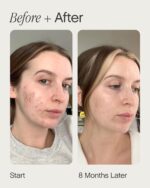 Topicals Faded Brightening and Clearing Serum | Reduces Discoloration Post-Blemish Marks Scars Spots Contains Kojic Acid Niacinamide Dermatologist-tested Vegan Cruelty-Free Fl Oz - Image 5