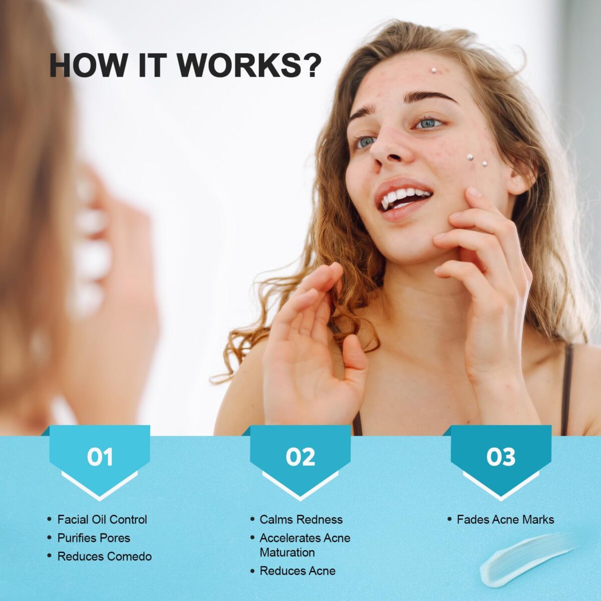 Acne Pimple Spot Treatment Cream: Cystic Hormonal Blackheads Blemish Remover for Face, Back and Body - with 10% Azelaic Acid - Teens 13-19 & Young Adult 20-30, 1.8 oz - Image 5