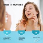 Acne Pimple Spot Treatment Cream: Cystic Hormonal Blackheads Blemish Remover for Face, Back and Body - with 10% Azelaic Acid - Teens 13-19 & Young Adult 20-30, 1.8 oz - Image 5