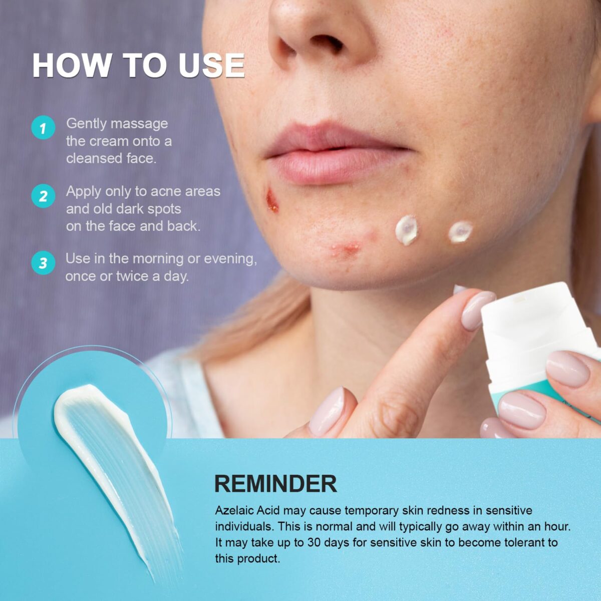Acne Pimple Spot Treatment Cream: Cystic Hormonal Blackheads Blemish Remover for Face, Back and Body - with 10% Azelaic Acid - Teens 13-19 & Young Adult 20-30, 1.8 oz - Image 7