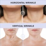 Neck Tightening Cream, Neck Firming Cream For Tightening and Firming, Fine lines, Loose & Sagging On Face, Decollete & Other Skin Areas - 1.7 OZ - Image 8