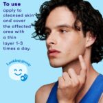 Clean & Clear Acne Spot Treatment Gel Cream with 2% Salicylic Acid, Oil-Free Topical Acne Treatment with Witch Hazel for Clinically Proven Results in 1 Day, Fragrance Free, 0.75 fl. oz - Image 5