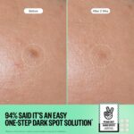 PEACE OUT Microneedling Dark Spot Brightening Dots - Image 5