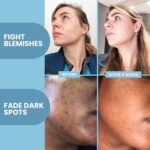 Eva Naturals Vitamin C Serum for Face – Anti Aging Dark Spot Remover with Retinol, Hyaluronic Acid, Niacinamide & Salicylic Acid – Face Serum for Women for Clear, Smooth, Radiant Skin - Image 8