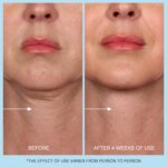 Retinol Neck Cream, Hyaluronic Acid and Caffeine Enriched Neck Firming Cream to Minimize Fine Lines & Dullness - 3-in-1 Moisturizing Cream for Neck, Chest and Face (50 ml/1.7 oz) - Image 7