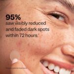 Peach Slices - Dark Spot Microdarts (9 ct) - Reduces Discoloration & Redness - Post-Pimple Patches - Niacinamide, Vitamin C, Hyaluronic Acid & Cica - Vegan & Cruelty Free - Korean Skin Care & Beauty - Image 7