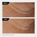 Revision Skincare Nectifirm Advanced® Neck Cream – Clinically Proven to Firm, Lift & Contour the Neck, Jawline & Décolletage, Correcting Visible Signs of Aging and Weight Loss - Image 6