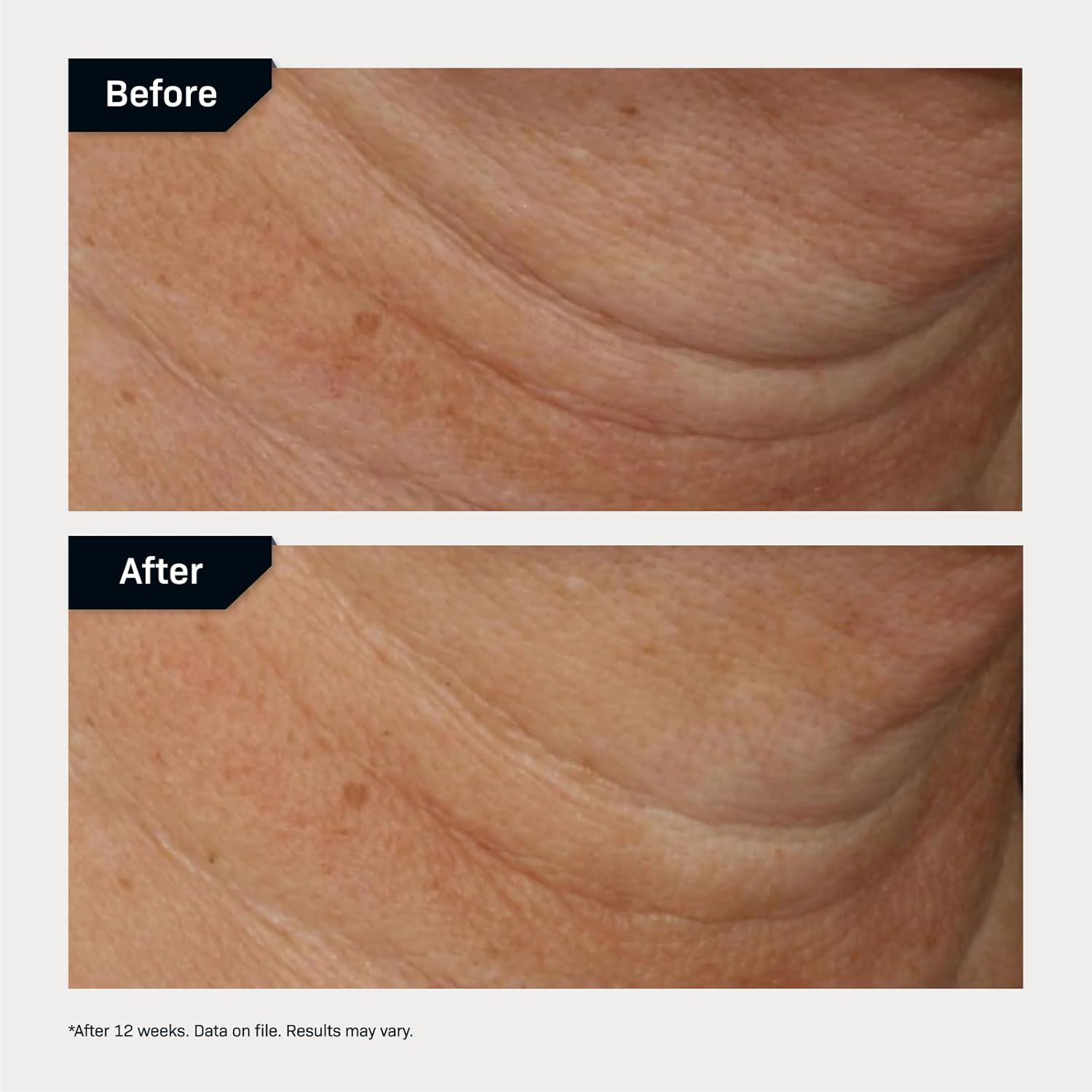 Revision Skincare Nectifirm Advanced® Neck Cream – Clinically Proven to Firm, Lift & Contour the Neck, Jawline & Décolletage, Correcting Visible Signs of Aging and Weight Loss - Image 6