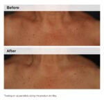 The Ordinary Niacinamide 5% Face and Body Emulsion, Dark Spot & Skin Tone Corrector, 3.4 Fl Oz - Image 7