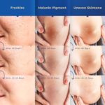 Dark Spot Remover for Face and Body: Corrector for Age, Sun, Freckle, Melasma, Brown Spots - Niacinamide, Vitamin C Formula - Use on Face, Hands, Underarms, Legs - 2 Oz - Image 6