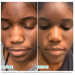 Urban Skin Rx® Retinol Rapid Repair + Dark Spot Treatment Facial Serum, Targets Fine Lines, Hyperpigmentation & Blemishes, Improves Appearance of Tone, Scarring, Fine Lines & Enlarged Pores,1 Fl Oz - Image 3