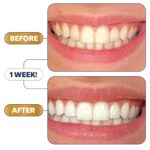 Lumineux Teeth Whitening Strips - 21 Treatments - Peroxide Free - Enamel Safe for Whiter Teeth - Whitening Without The Sensitivity - Dentist Formulated - Sensitivity - Image 4