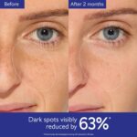 Caudalie Vinoperfect Brightening Dark Spot Serum Vitamin C Alternative - 62x More Effective than Vitamin C with Viniferine for a Visibly Brighter Even Complexion - Image 5