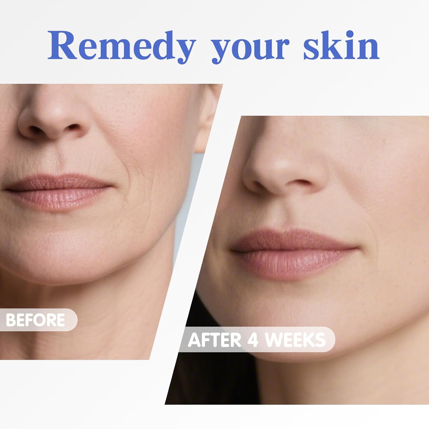 Neck Firming Cream | Face Moisturizer for Women - Anti Aging Formula for Tightening and Firming with Retinol,Collagen,Hyaluronic Acid | Day & Night Moisturizer Suited for Most Skin Types,1.7 OZ - Image 7