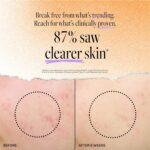 DERMA E Acne Spot Treatment, Acne Blemish Control Treatment Serum, 2 Fl Oz, Clinically Studied to Help Fight Blackheads, Breakouts and Cystic Acne for Clearer Looking Skin - Image 4