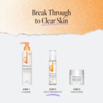 DERMA E Acne Spot Treatment, Acne Blemish Control Treatment Serum, 2 Fl Oz, Clinically Studied to Help Fight Blackheads, Breakouts and Cystic Acne for Clearer Looking Skin - Image 6