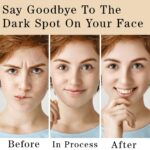 Dark Spot Corrector Cream,Dark Spot Remover for Face and Body with Collagen,Niacinamide,Intimate Areas and Bleaching,Neck,Underarm,Elbow,Inner Thigh and Knees,Bikini Line,Instant Result,2 oz - Image 5