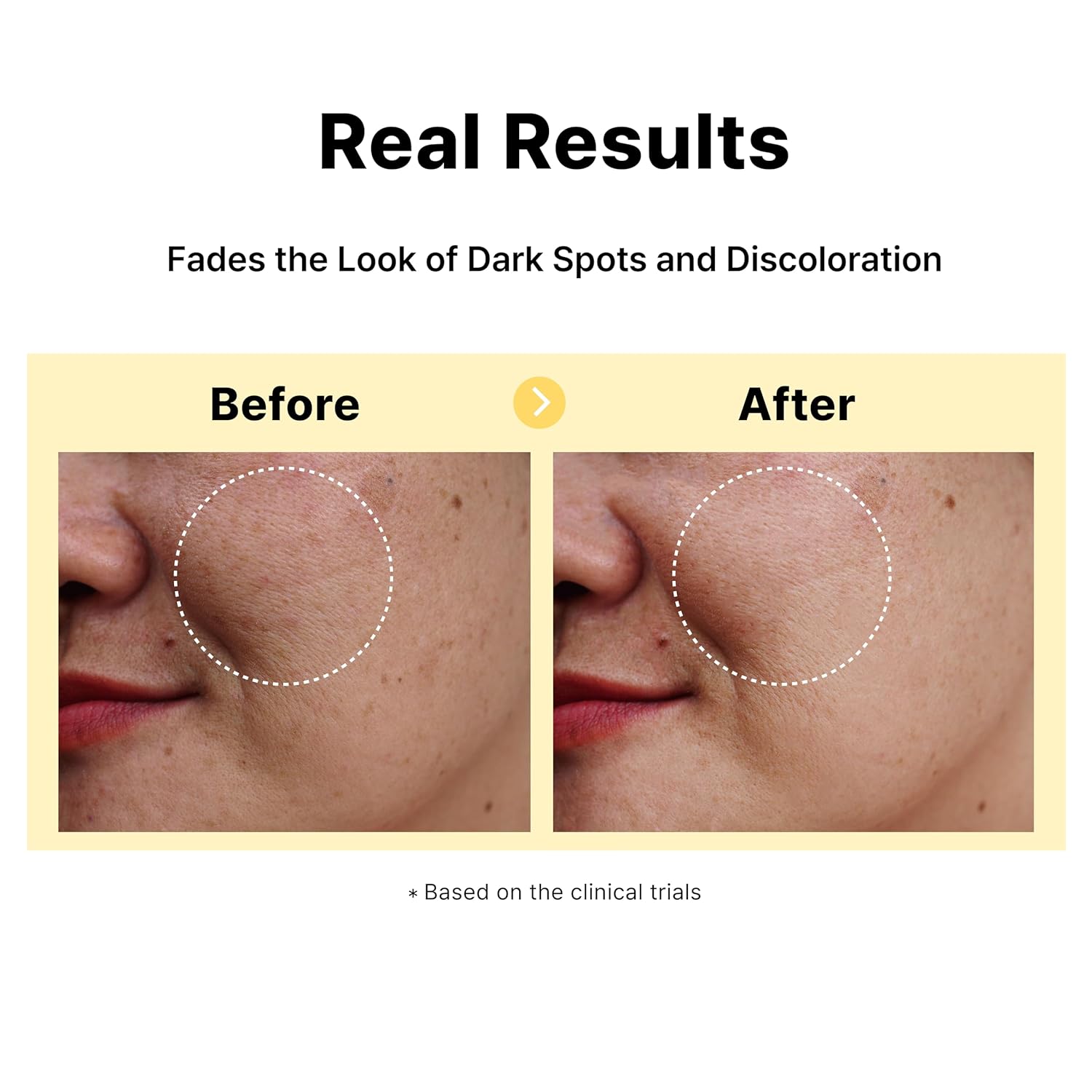 5% Tranexamic Acid Serum with 5% Niacinamide, Bakuchiol, Dark Spot Correcting Serum, Fade Discoloration, Hyperpigmentation, Acne Scars, Sun Spots, Blemish Remover, Korean Skincare,1Fl Oz - Image 5