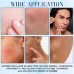 Organics Acne Balm, Acne & Redness Killer, Clearing Cream for Man，Remove Skin Care Set(1 pcs) - Image 6