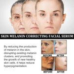 Melanin Correcting Facial Serum, Dark Spot Correcting Glow Serum, Mild and Not Stimulating for Any Part (2pcs) - Image 4