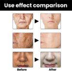 Melanin Correcting Facial Serum, Dark Spot Correcting Glow Serum, Mild and Not Stimulating for Any Part (2pcs) - Image 6