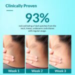 FIXDERMA Nigrifix Cream for Acanthosis Nigricans with Lactic Acid | Dermatologist Tested Retinol Cream | Useful for Dark Body Parts like Neck, Ankles, Armpits & Elbows –3.52 FlOz - Image 7