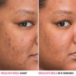 IT Cosmetics Bye Bye Dark Spots 4% Niacinamide Serum - Visibly Reduces Dark Spots & Improves Skin Clarity In 8 Weeks - Facial Serum with 1% Ethyl Vitamin C - For All Skin Types - 1 Fl. Oz - Image 3