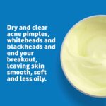 De La Cruz 10% Sulfur Ointment Travel Size - Cystic Acne Treatment for Face and Body - Daily 10 Min Spot Treatment Mask Safe and Effective Game Changing Hormonal Acne Treatment 0.21oz 6g - Image 4