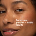 MAREE Invisible Pimple Patches - Clear Pimple Patches for Face - Hydrocolloid Acne Patches Anti Blemish - Zit Stickers for Face - Parches Para Acne - Pinple Zit Patches Pimple Stickers - 72 Dots - Image 3