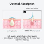 MAREE Invisible Pimple Patches - Clear Pimple Patches for Face - Hydrocolloid Acne Patches Anti Blemish - Zit Stickers for Face - Parches Para Acne - Pinple Zit Patches Pimple Stickers - 72 Dots - Image 12