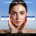 Dark Spot Remover for Face & Body – Dark Spot Corrector for Face - Hyperpigmentation, Age spot, Sun Spot, Melasma & Freckles – Brightening & Even Skin Tone Treatment (1.7 Fl Oz) - Image 5