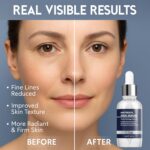 Matrixyl 3000 Total Package Serum with Hyaluronic Acid, Argireline Serum for Anti-Wrinkle, Collagen Boosting, Anti-Aging & face hydrating, Deep Wrinkle Repair & Firming for Fine - 30ml - Image 6