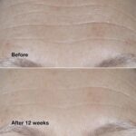 Clinique Smart Clinical Repair Broad Spectrum SPF 30 Wrinkle Correcting Cream with Peptides, Hyaluronic Acid + Glycerin | Protecting + Repairing - Image 5