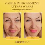 Bee Venom Wrinkle Cream: Wrinkle Cream for Women with Bee Venom Hyaluronic acid Niacinamide and Peptides - for fine lines and face firming 50 - Image 5