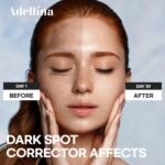 Dark Spot Remover for Face: Dark Spot Corrector for Sun Spots, Age Spots & Uneven Skin Tone - Vitamin C, Alpha Arbutin & Niacinamide for Even Skin Tone (1 Fl Oz) - Image 4