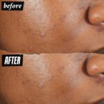 Kiehl's Truly Targeted Acne-Clearing Pimple Patch with 2% Salicylic Acid, Invisible Liquid Spot Treatment, 4% Niacinamide Fades Post-Acne Marks, 0.2% Licorice Root Soothes Redness - 0.5 fl oz - Image 4