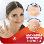 Asepxia 2% Salicylic Acid Acne Spot Treatment Cream | Drying Formula Targets Acne, Clears & Prevents Blemishes, Reduces Redness, Penetrates Pores, Pimple Cream, 1 Oz, 1-Pack - Image 4