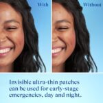 Differin Acne Patches, Pimple Patches for Acne Prone Skin, Formulated with Salicylic Acid and Centella, Fast Triple Action Power Patch for Day & Night, Dermatologist Tested, 36 Count - Image 7