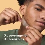 Mighty Patch Surface Large Pimple Patches for Face from Hero Cosmetics, Acne Spot for Body, Cheek, Forehead, and Chin, Pimple Stickers, Hydrocolloid Covers, Vegan-friendly, 10 Count - Image 3