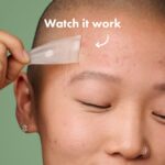 Mighty Patch Surface Large Pimple Patches for Face from Hero Cosmetics, Acne Spot for Body, Cheek, Forehead, and Chin, Pimple Stickers, Hydrocolloid Covers, Vegan-friendly, 10 Count - Image 5