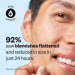 Peach Slices - Acne Spot Dots (60 ct) - Hydrocolloid Pimple Patches for Face - Absorb Gunk, Protect Picking & Support Healing - 3 Sizes (7, 10, & 12mm) - Vegan, Cruelty Free, Korean Skin Care & Beauty - Image 5